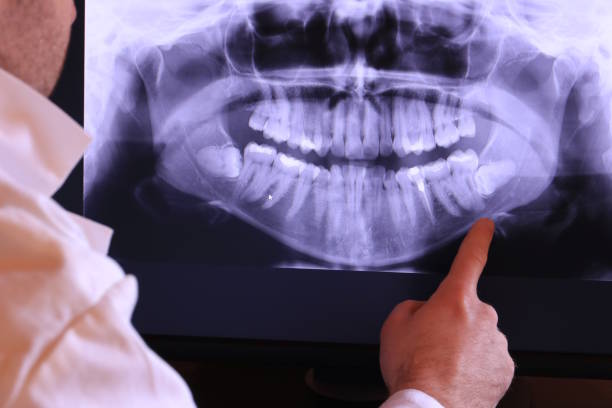 Best Emergency Treatment for Oral Infections in Marion, WI